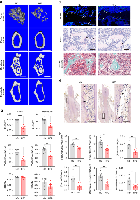 Multiomics profiling reveals VDR as a central regulator of mesenchymal stem cell senescence with a known association with osteoporosis after high-fat diet exposure