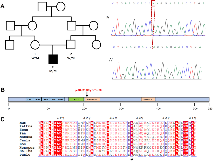 Homozygous variant in DRC3 (LRRC48) gene causes asthenozoospermia and male infertility