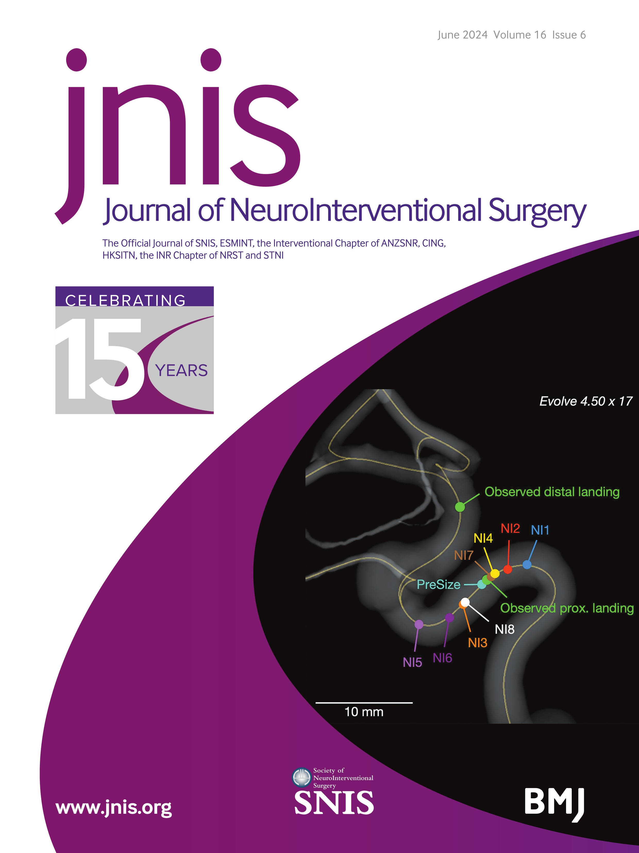 Association of the combined stereotactic radiosurgery and embolization strategy and long-term outcomes in brain arteriovenous malformations with a volume <=10 mL: a nationwide multicenter observational prospective cohort study