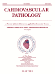 Cardiac Genetic Test Yields and Genotype-Phenotype Correlations from Large Cohort Investigated by Medical Examiner's Office
