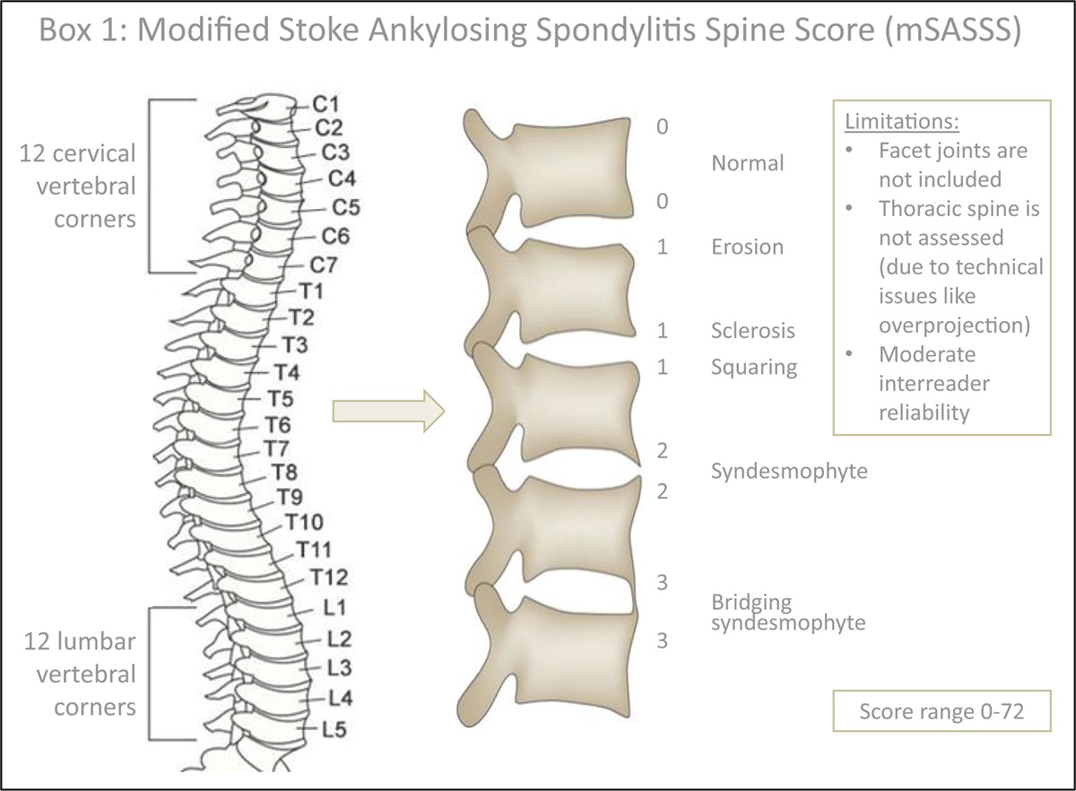 Disease modification in axial spondyloarthritis – still a controversy?