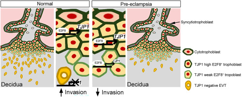 TJP1 suppresses trophoblast cell invasion by expressing E2F8 in the human placenta