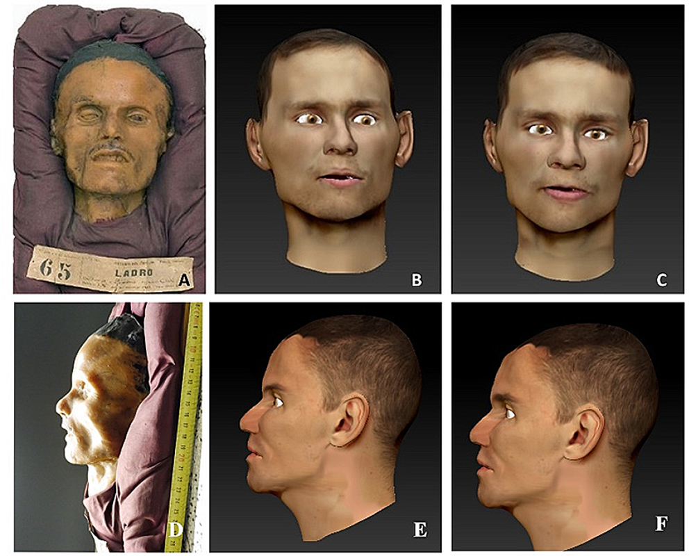 Applications of forensic anthropology methodology: accuracy of virtual face reproductions performed on the Tenchini collection