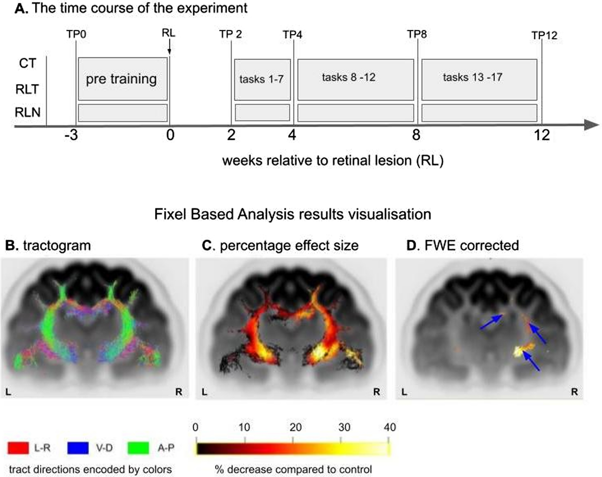 Visual training after central retinal loss limits structural white matter degradation: an MRI study