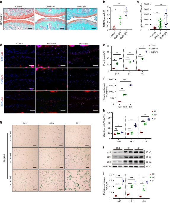 Matrix stiffening promotes chondrocyte senescence and the osteoarthritis development through downregulating HDAC3