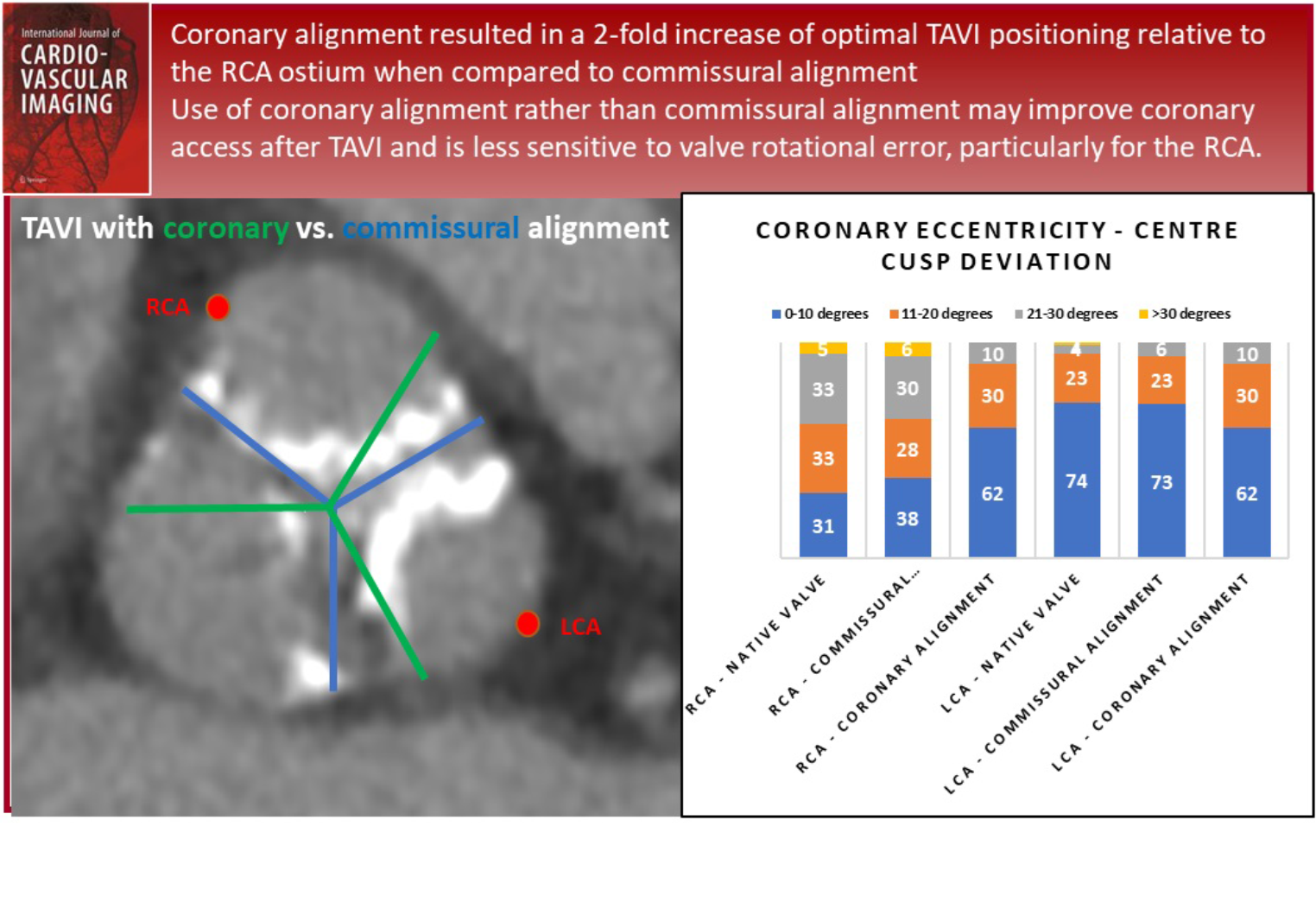 Impact of commissural versus coronary alignment on risk of coronary obstruction following transcatheter aortic valve implantation