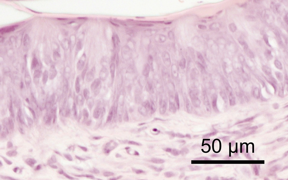 The existence of cells exhibiting characteristics of both Type II and Type III cells in rat taste buds. An immunohistochemical and electron-microscopic study