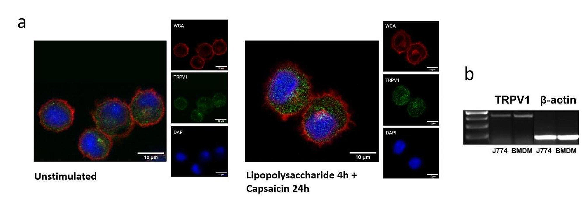 Lipopolysaccharide pretreatment increases the sensitivity of the TRPV1 channel and promotes an anti-inflammatory phenotype of capsaicin-activated macrophages