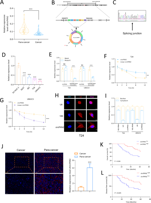 CircPKN2 promotes ferroptosis in bladder cancer by promoting the ubiquitination of Stearoyl-CoA Desaturase 1