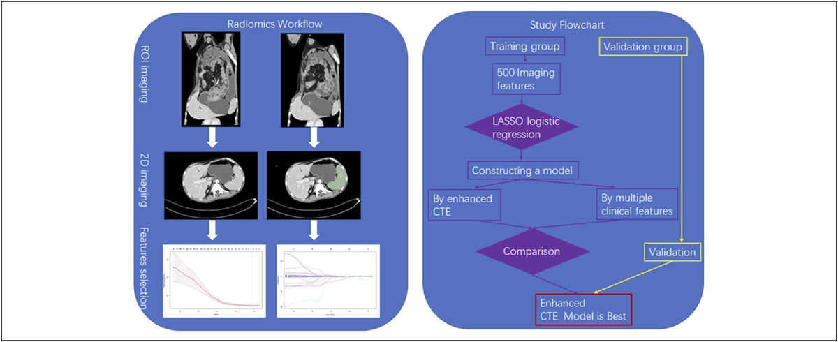 Are Radiomic Spleen Features Useful for Assessing the Response to Infliximab in Patients With Crohn's Disease? A Multicenter Study