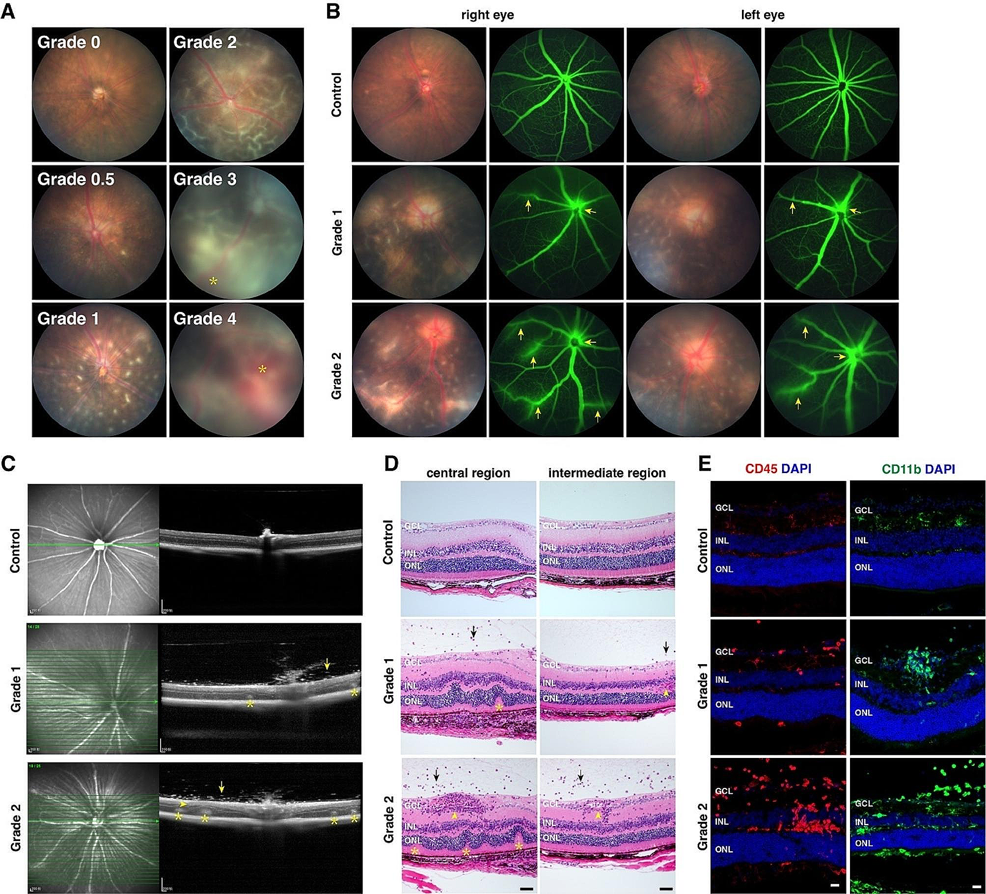 CCR5-overexpressing mesenchymal stem cells protect against experimental autoimmune uveitis: insights from single-cell transcriptome analysis