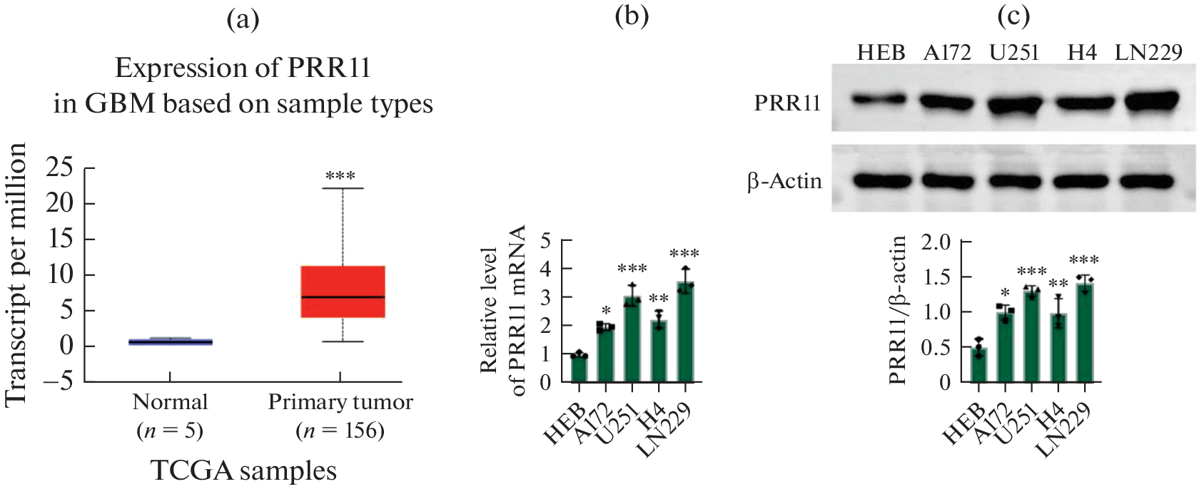 Knockdown of PRR11 Induces Autophagy in Glioma Cells by Inhibiting Akt/mTOR Signaling Pathway