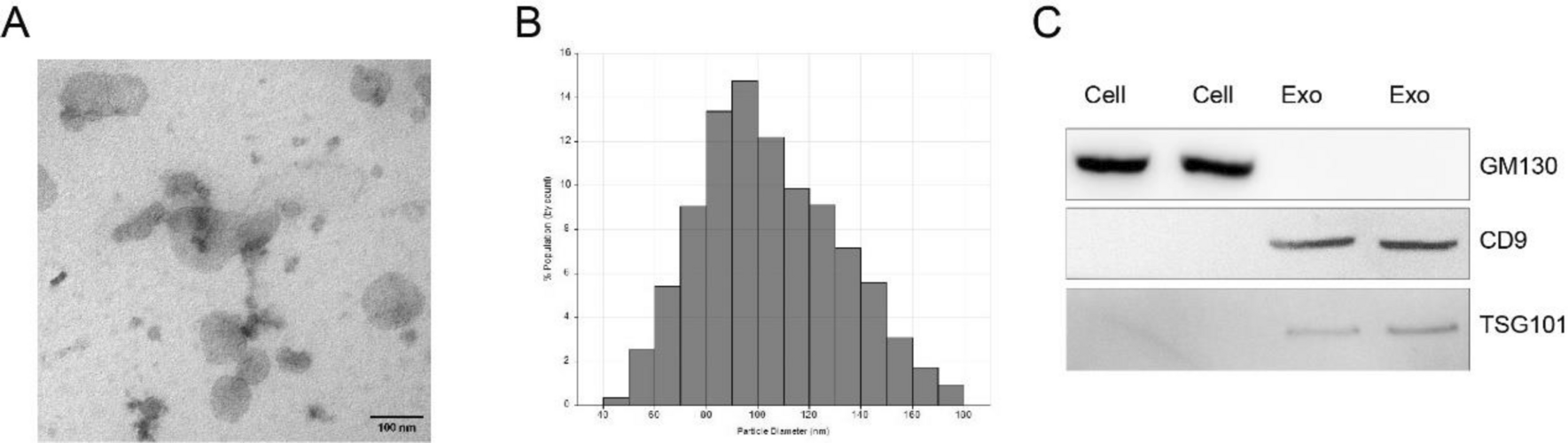 Plasma-Derived Exosomal tRF-Phe-GAA-001 and tRF-Gly-GCC-037 as Novel Diagnostic Biomarkers for Cervical Cancer