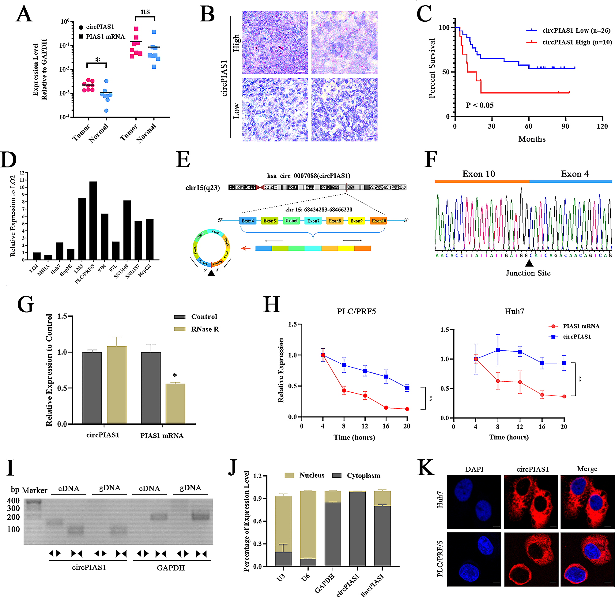 CircPIAS1 promotes hepatocellular carcinoma progression by inhibiting ferroptosis via the miR-455-3p/NUPR1/FTH1 axis