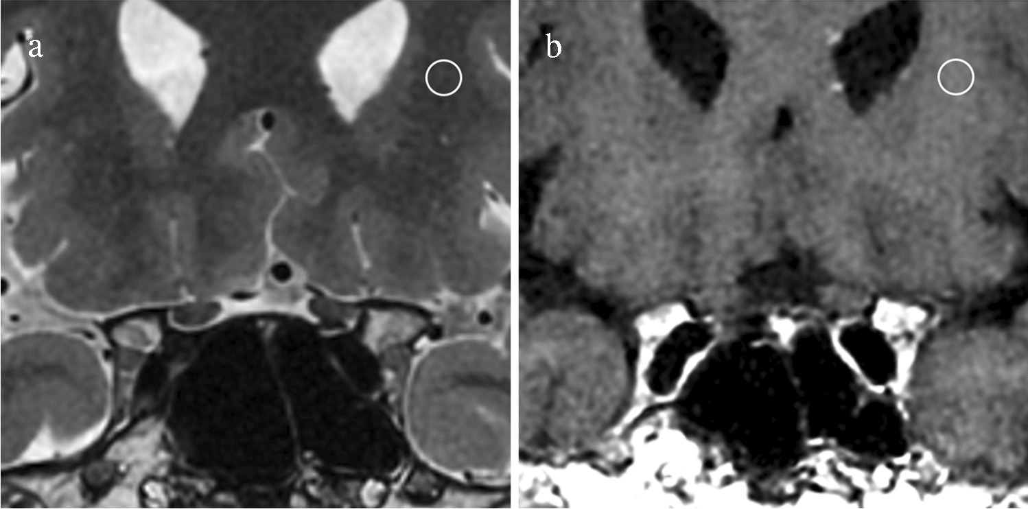 Usefulness of pituitary high-resolution 3D MRI with deep-learning-based reconstruction for perioperative evaluation of pituitary adenomas