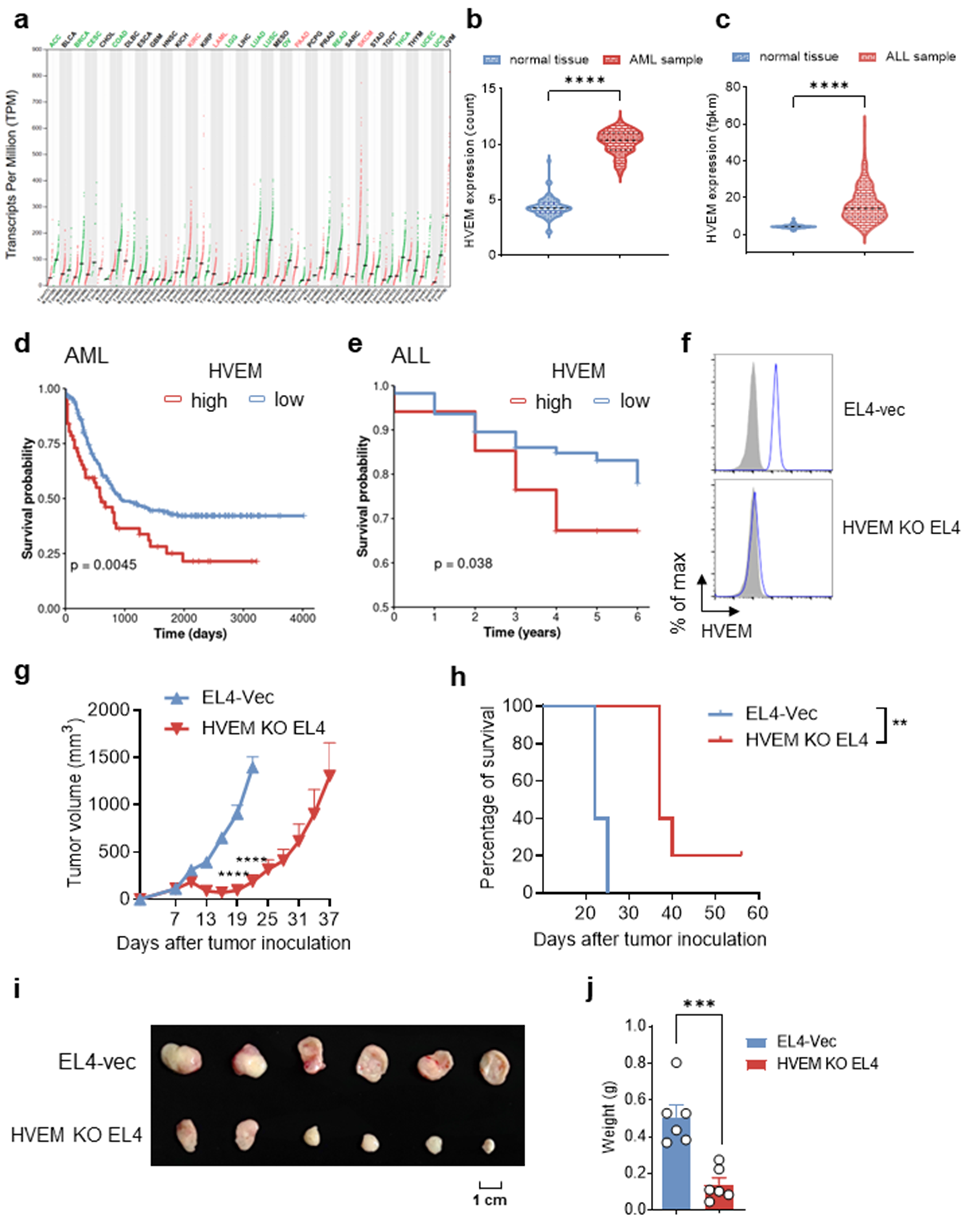 HVEM in acute lymphocytic leukemia facilitates tumour immune escape by inhibiting CD8+ T cell function