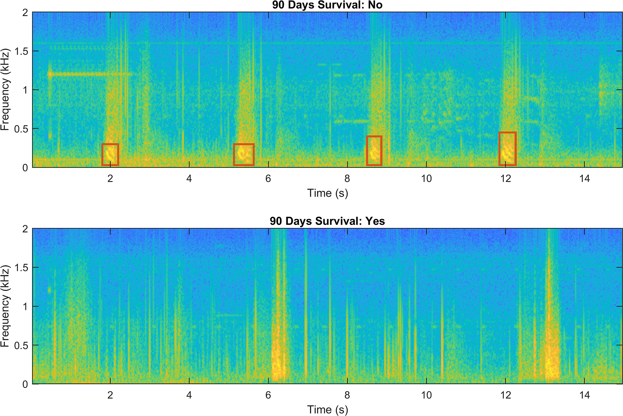 Back to the future: the novel art of digital auscultation applied in a prospective observational study of critically ill Covid-19 patients