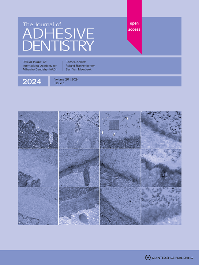 The Influence of Erbium Laser Pretreatment on Dentin Shear Bond Strength and Bond Failure Modes: A Systematic Review and Network Meta-Analysis