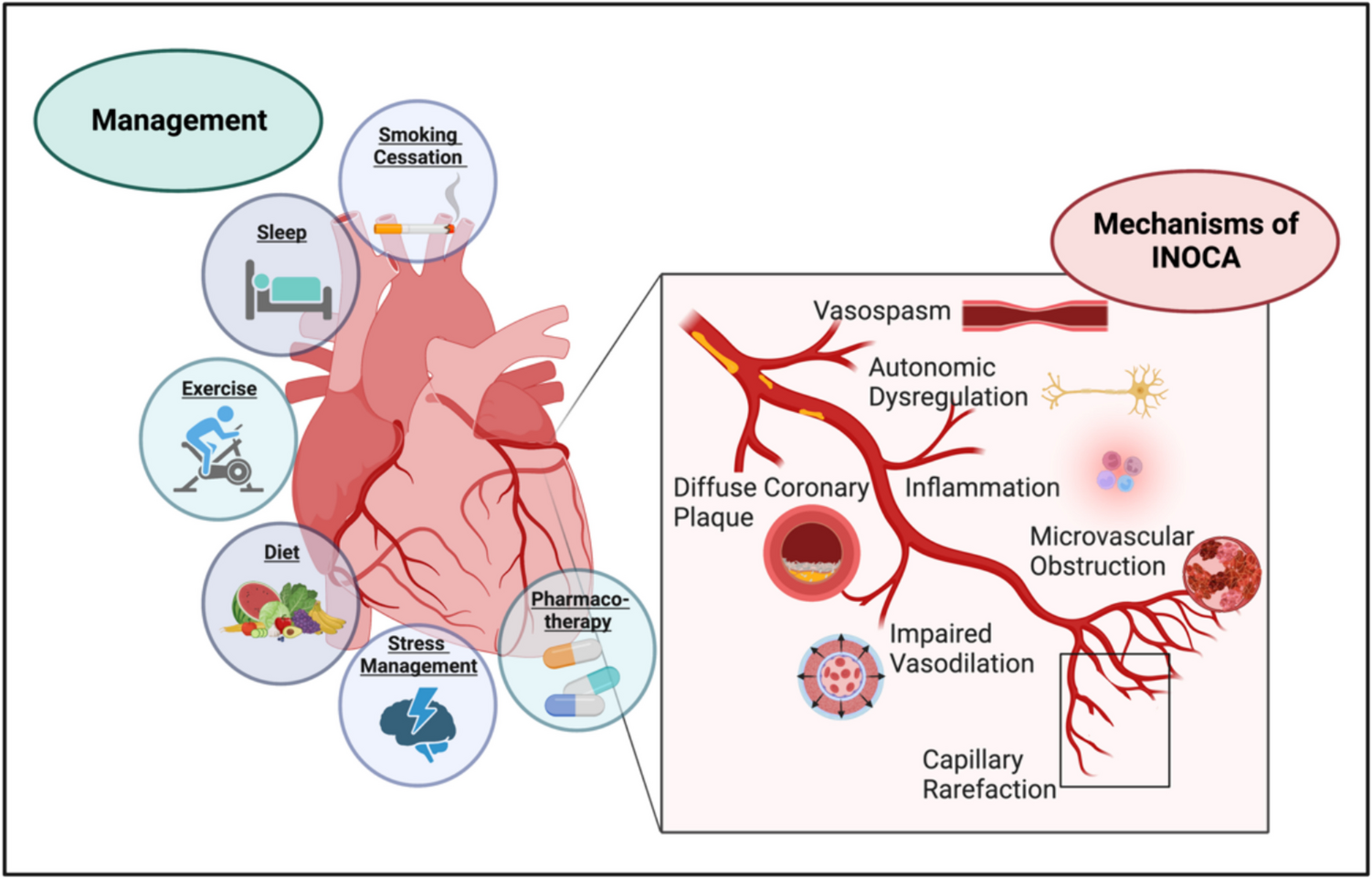 Coronary Microvascular Dysfunction in Women