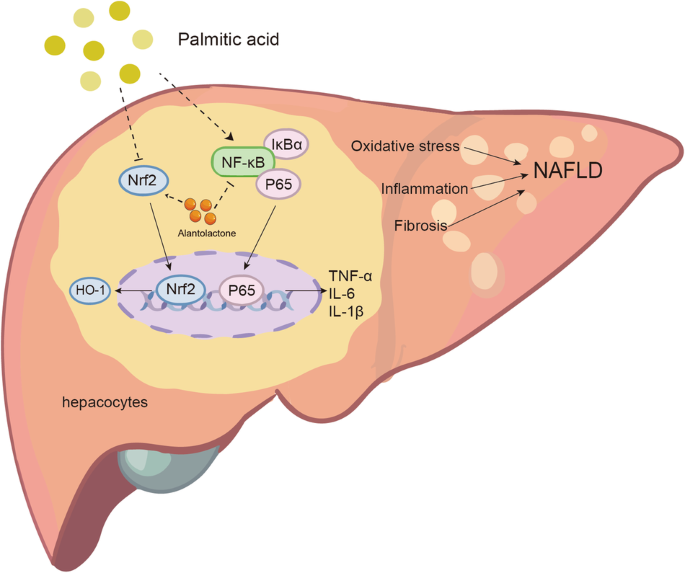 Alantolactone attenuates high-fat diet-induced inflammation and oxidative stress in non-alcoholic fatty liver disease