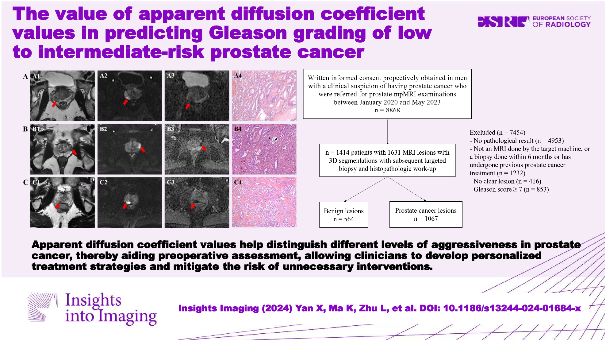 The value of apparent diffusion coefficient values in predicting Gleason grading of low to intermediate-risk prostate cancer