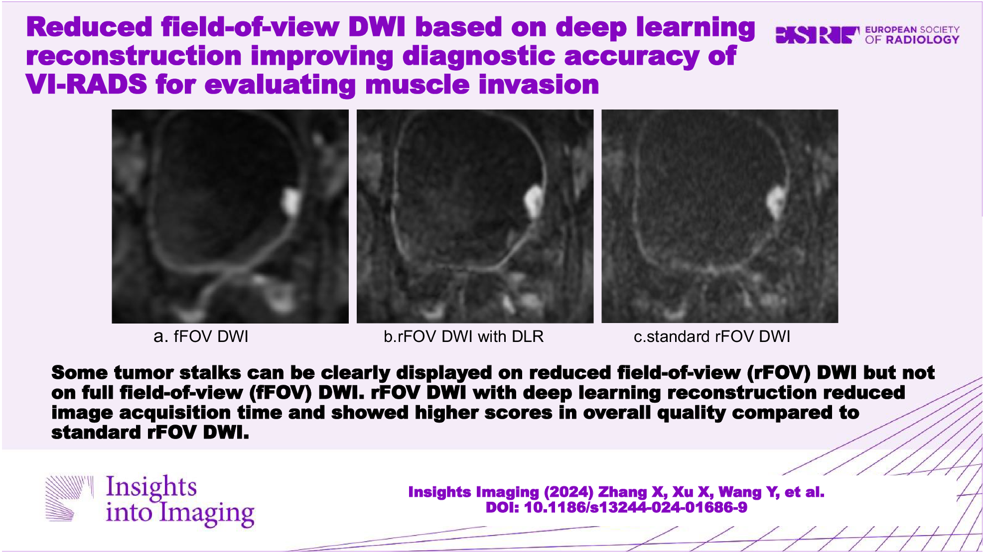Reduced field-of-view DWI based on deep learning reconstruction improving diagnostic accuracy of VI-RADS for evaluating muscle invasion