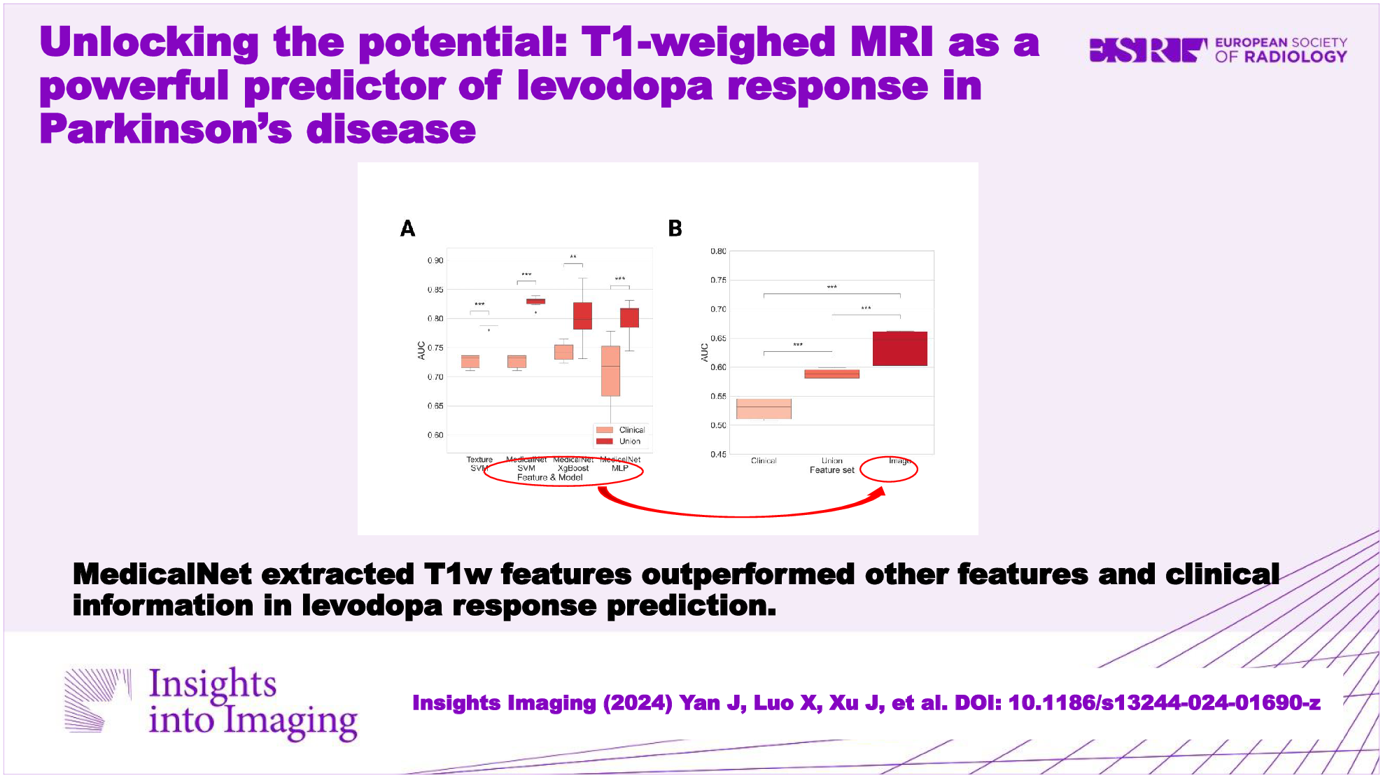 Unlocking the potential: T1-weighed MRI as a powerful predictor of levodopa response in Parkinson’s disease