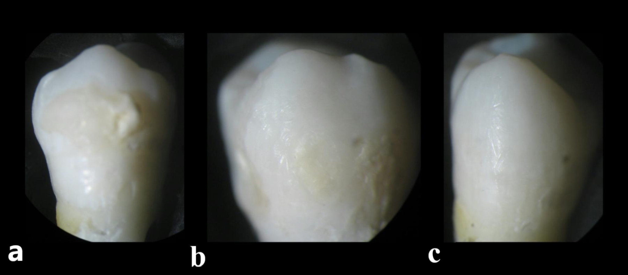 Performance of two laser motion modes versus conventional orthodontic ceramic brackets debonding technique on enamel surface topography