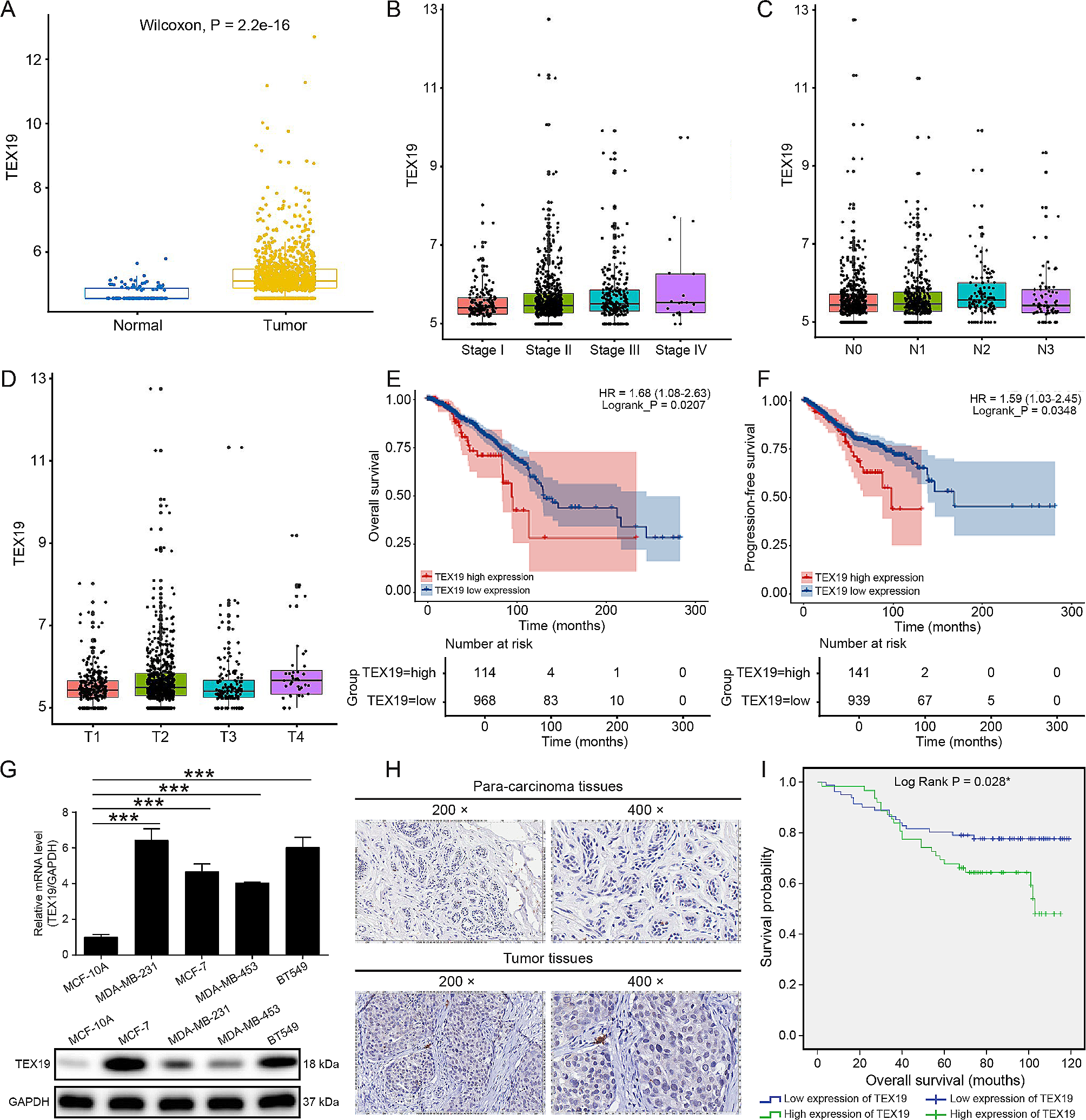 TEX19 increases the levels of CDK4 and promotes breast cancer by disrupting SKP2-mediated CDK4 ubiquitination