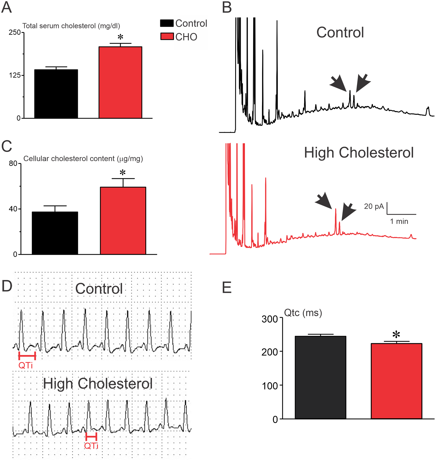 Electrocontractile remodeling of isolated cardiomyocytes induced during early-stage hypercholesterolemia