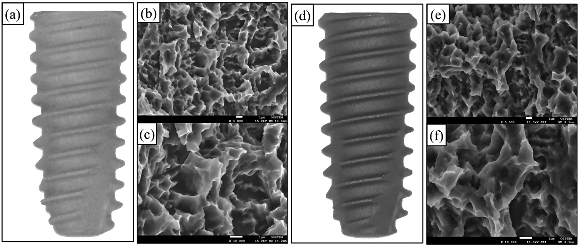 A randomized controlled trial of immediate implant placement comparing hydroxyapatite nano-coated and uncoated sandblasted/acid-etched implants using a digital surgical guide