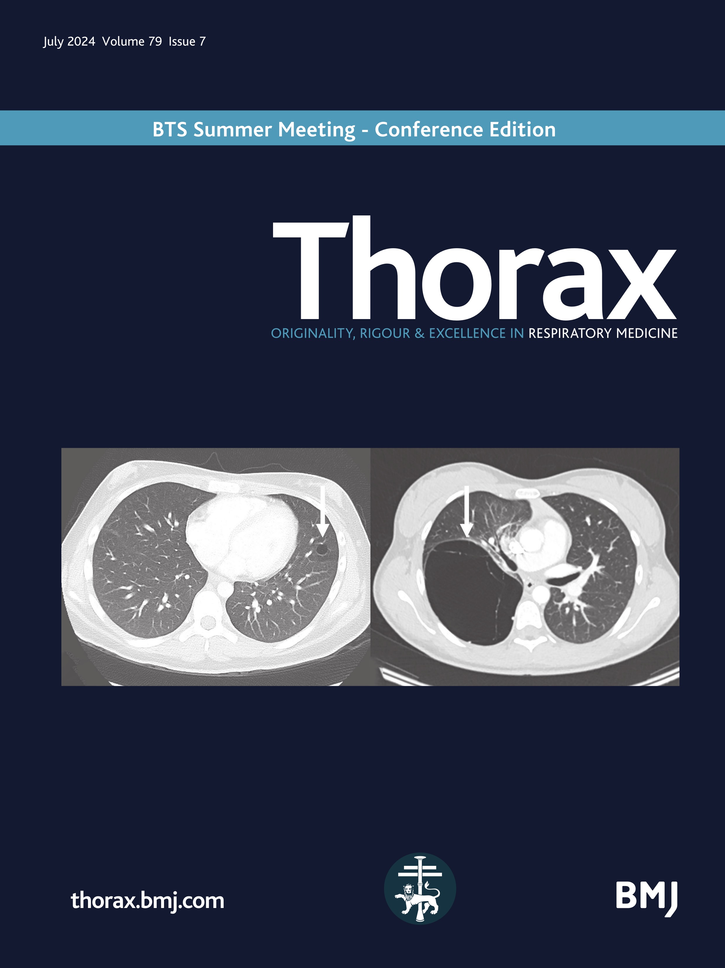 Ablation for lung cancer: hot or cold intervention