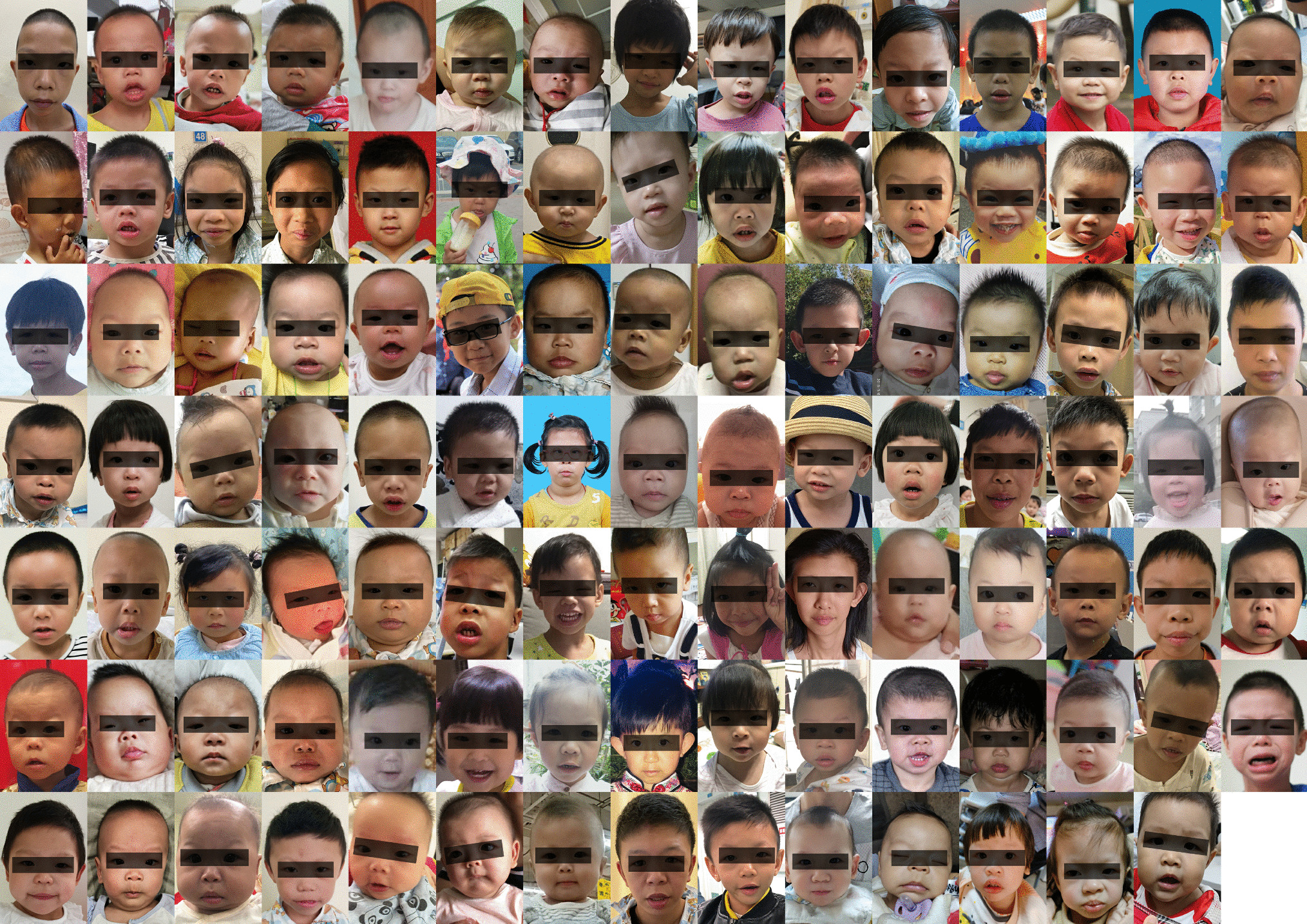 Optimization and evaluation of facial recognition models for Williams-Beuren syndrome