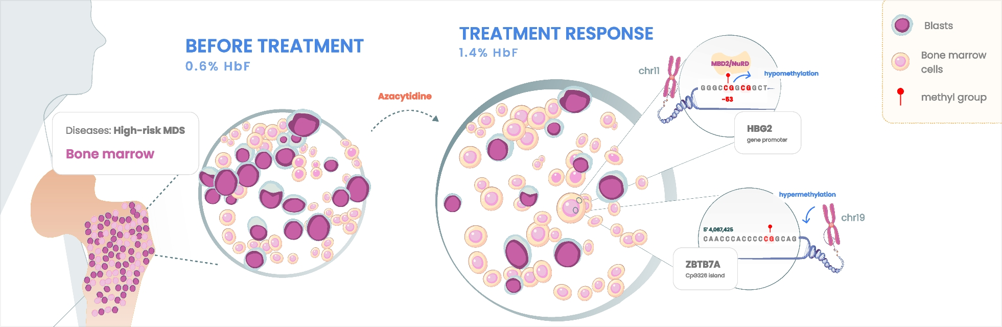 Fetal hemoglobin induction in azacytidine responders enlightens methylation patterns related to blast clearance in higher-risk MDS and CMML