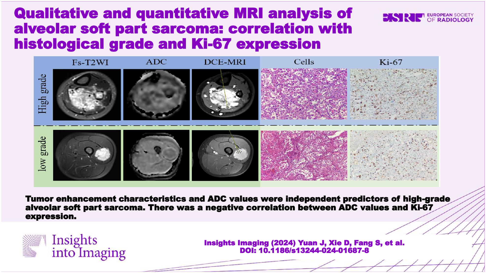 Qualitative and quantitative MRI analysis of alveolar soft part sarcoma: correlation with histological grade and Ki-67 expression