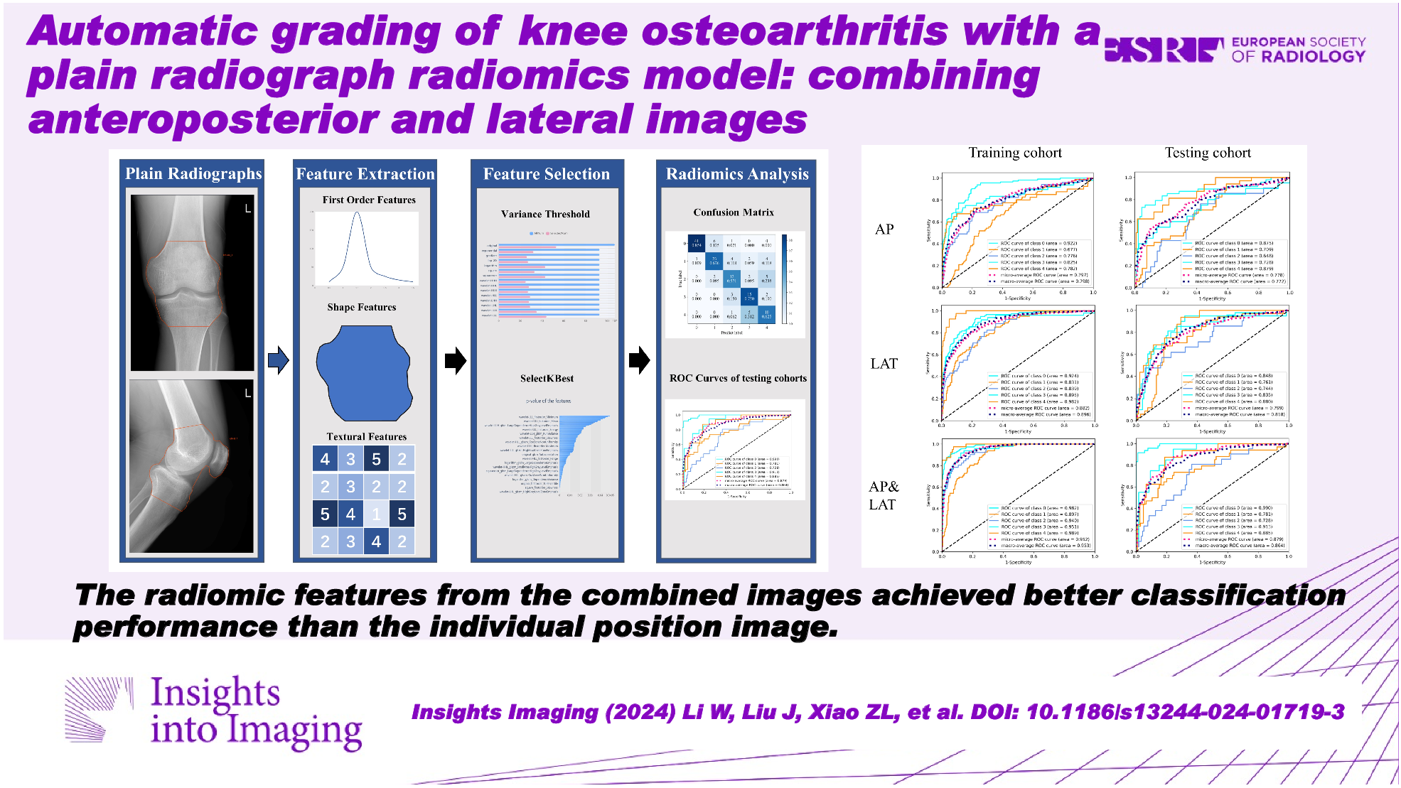 Automatic grading of knee osteoarthritis with a plain radiograph radiomics model: combining anteroposterior and lateral images