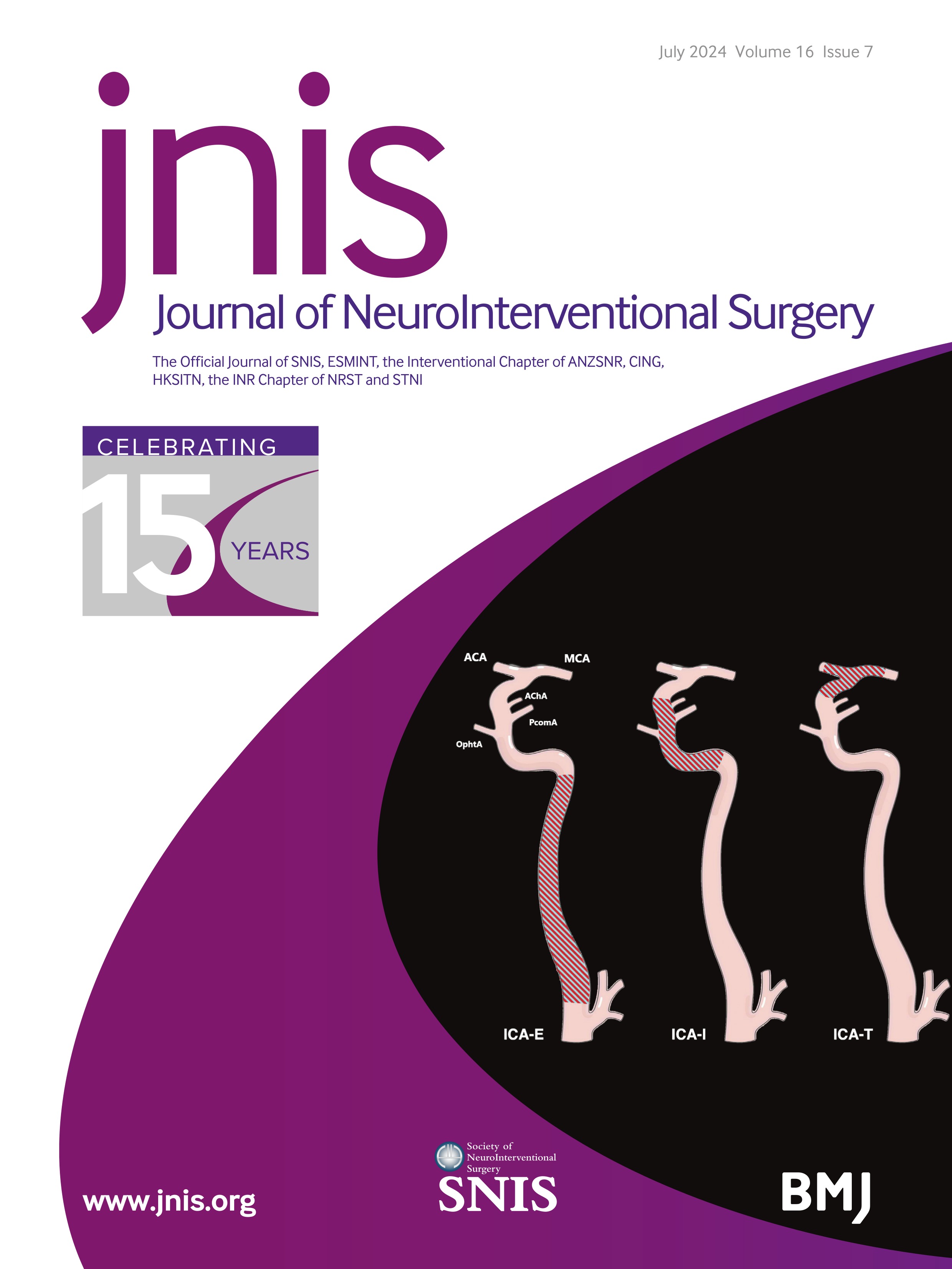 Relation between duration of dual antiplatelet therapy and risk of ischemic stroke after stent-assisted treatment of cerebral aneurysm (DAPTS ACE-registry)