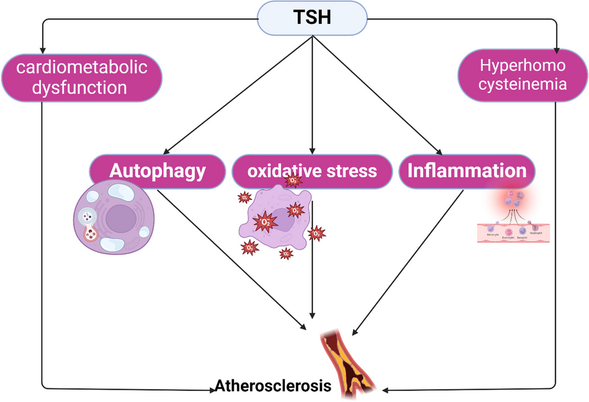 Increased thyroid stimulating hormone (TSH) as a possible risk factor for atherosclerosis in subclinical hypothyroidism