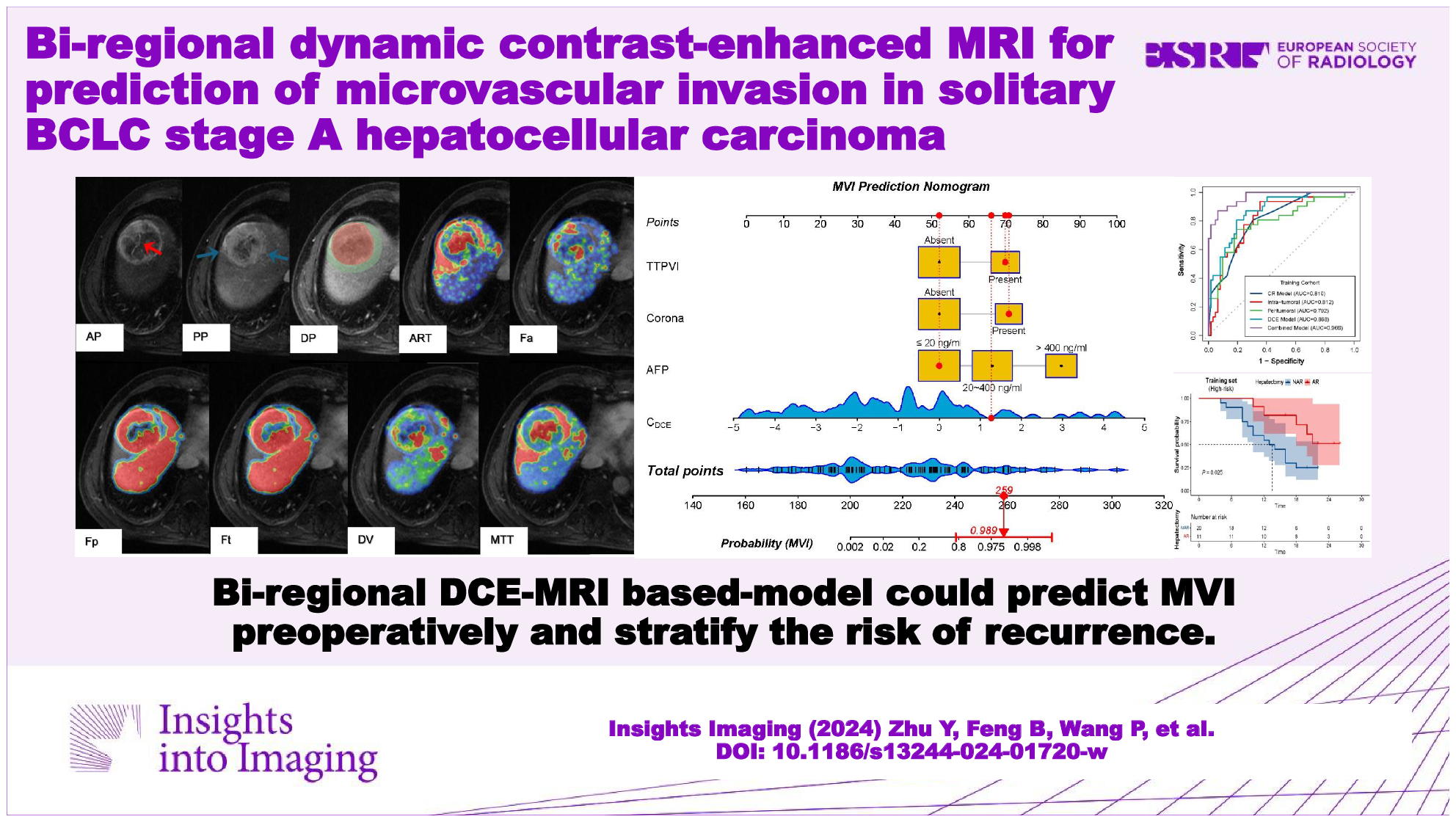Bi-regional dynamic contrast-enhanced MRI for prediction of microvascular invasion in solitary BCLC stage A hepatocellular carcinoma
