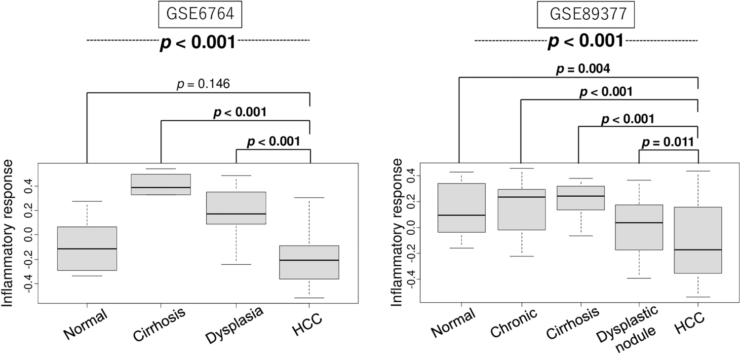 Higher inflammatory response in hepatocellular carcinoma is associated with immune cell infiltration and a better outcome