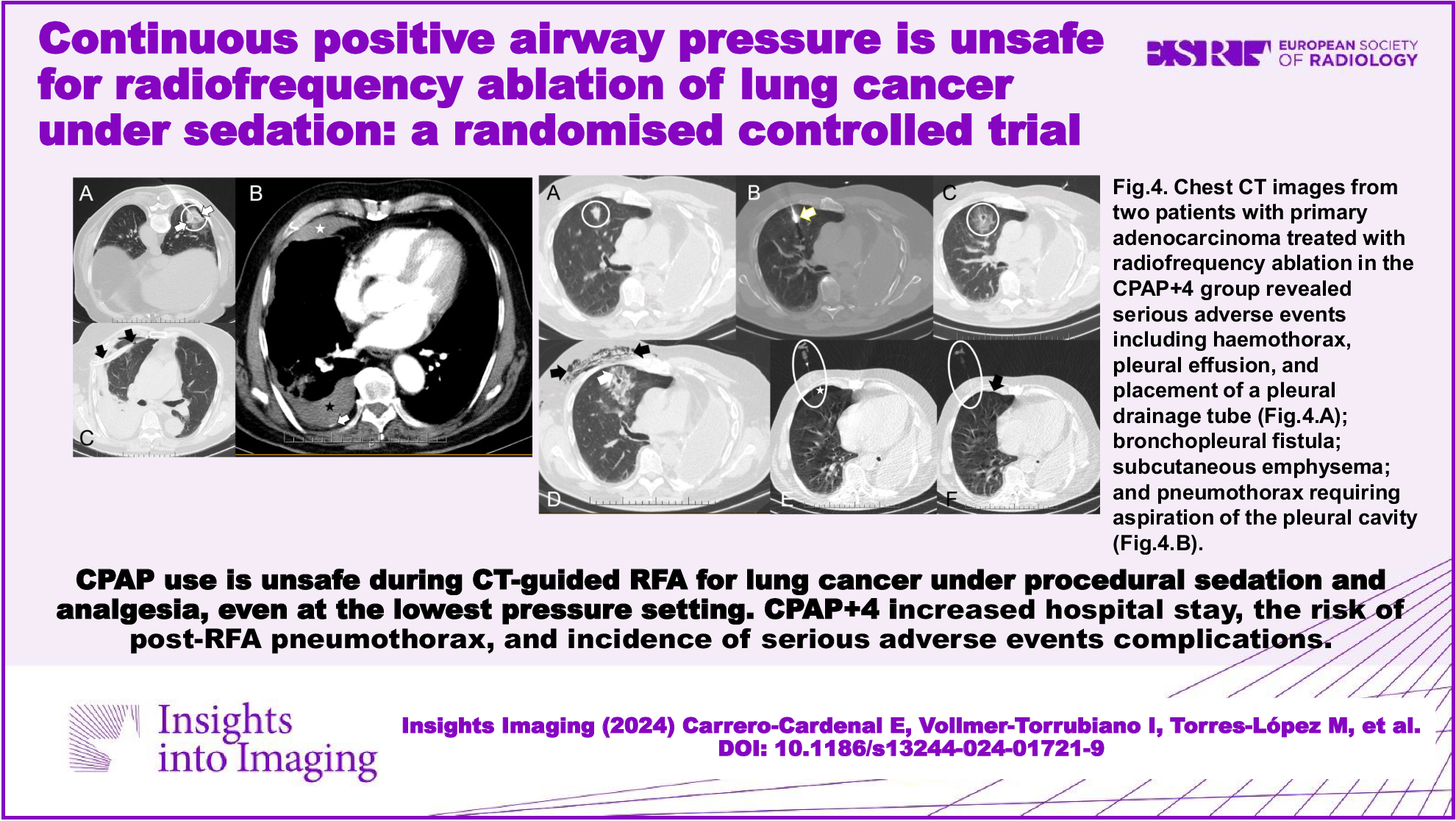 Continuous positive airway pressure is unsafe for radiofrequency ablation of lung cancer under sedation: a randomised controlled trial