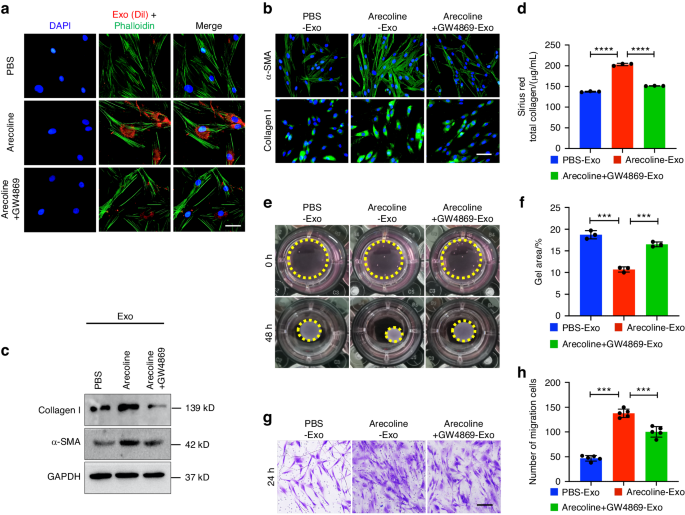Exosomal miR-17-5p derived from epithelial cells is involved in aberrant epithelium-fibroblast crosstalk and induces the development of oral submucosal fibrosis