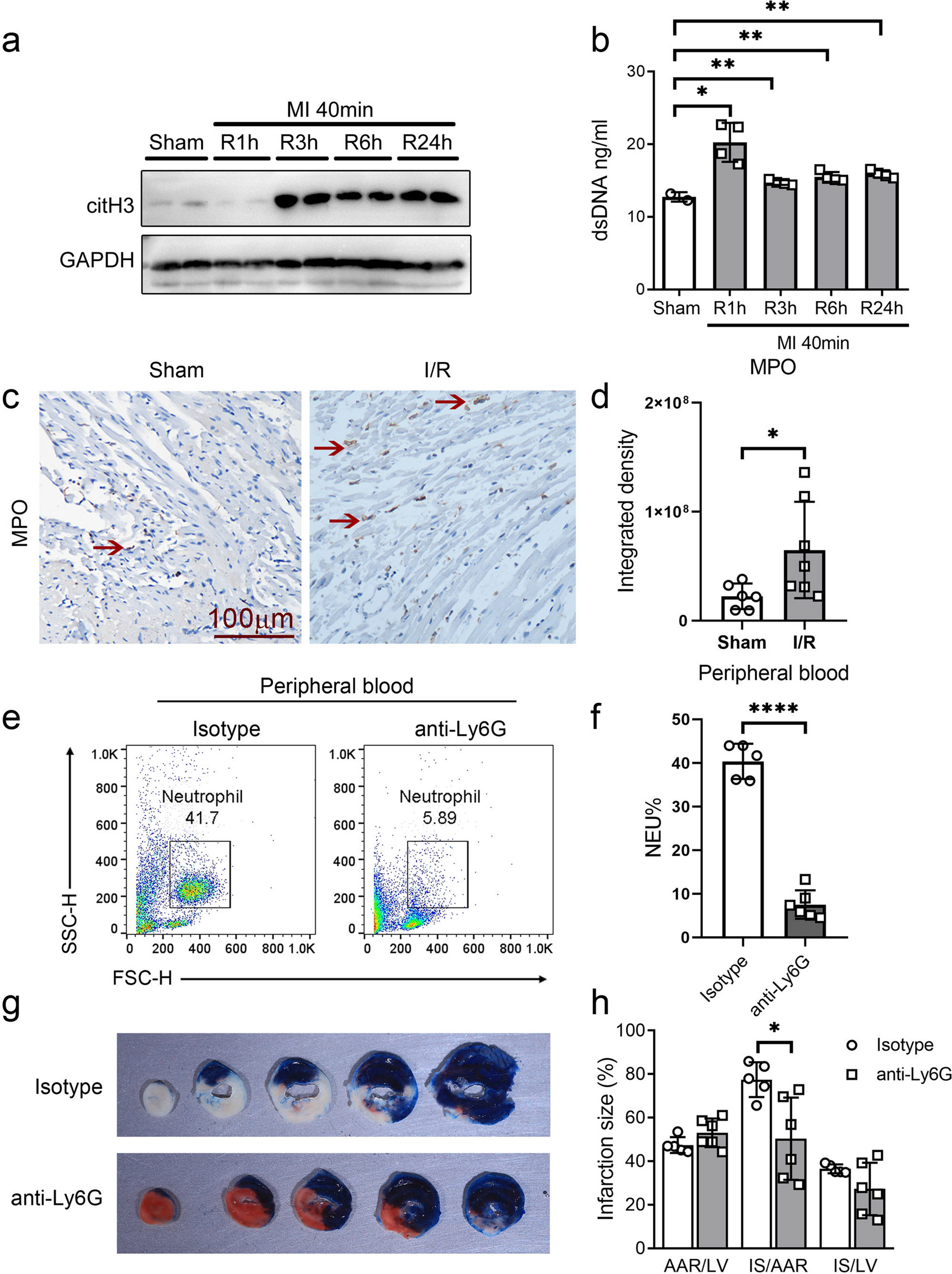 Blocking the TRAIL-DR5 Pathway Reduces Cardiac Ischemia–Reperfusion Injury by Decreasing Neutrophil Infiltration and Neutrophil Extracellular Traps Formation