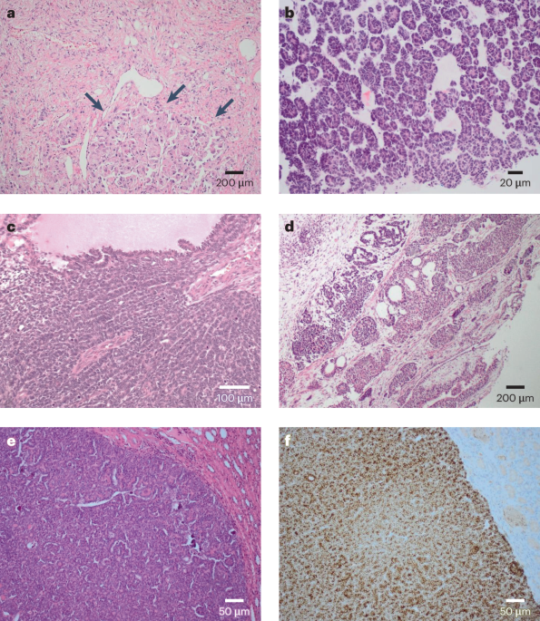 Renal mass biopsy — a practical and clinicopathologically relevant approach to diagnosis