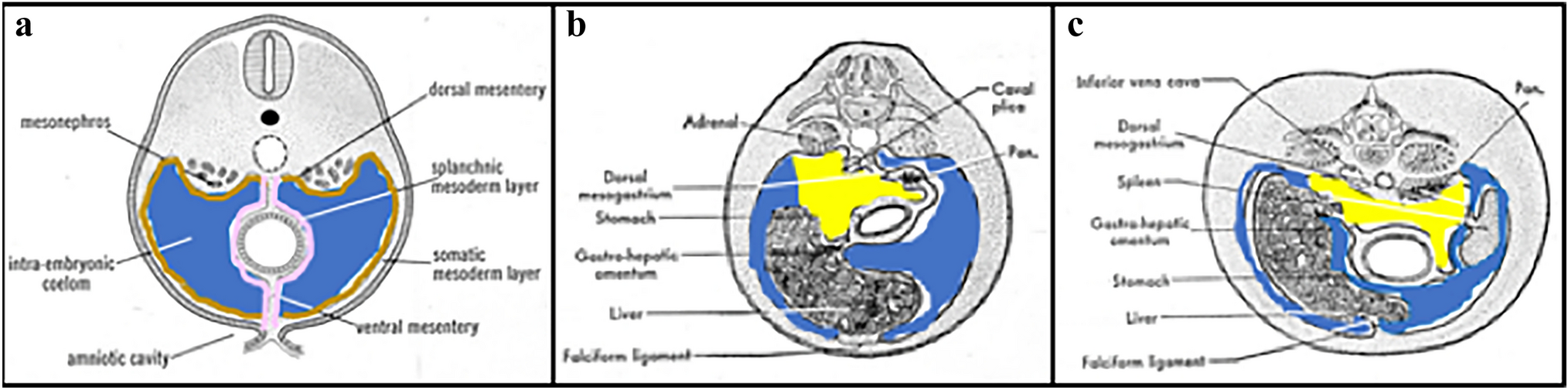 Navigating the labyrinth of peritoneal and extraperitoneal anatomy: abdominal spread made easy with a case based review