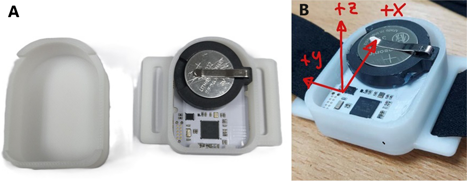 Comparison of sleep position monitoring between NaTu sensor and video-validated polysomnography in patients with obstructive sleep apnea