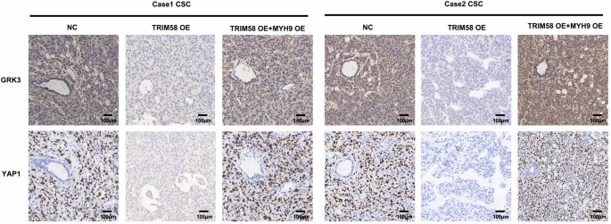 Correction: TRIM58 downregulation maintains stemness via MYH9-GRK3-YAP axis activation in triple-negative breast cancer stem cells