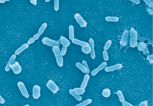 Progestin production by the gut microbiota