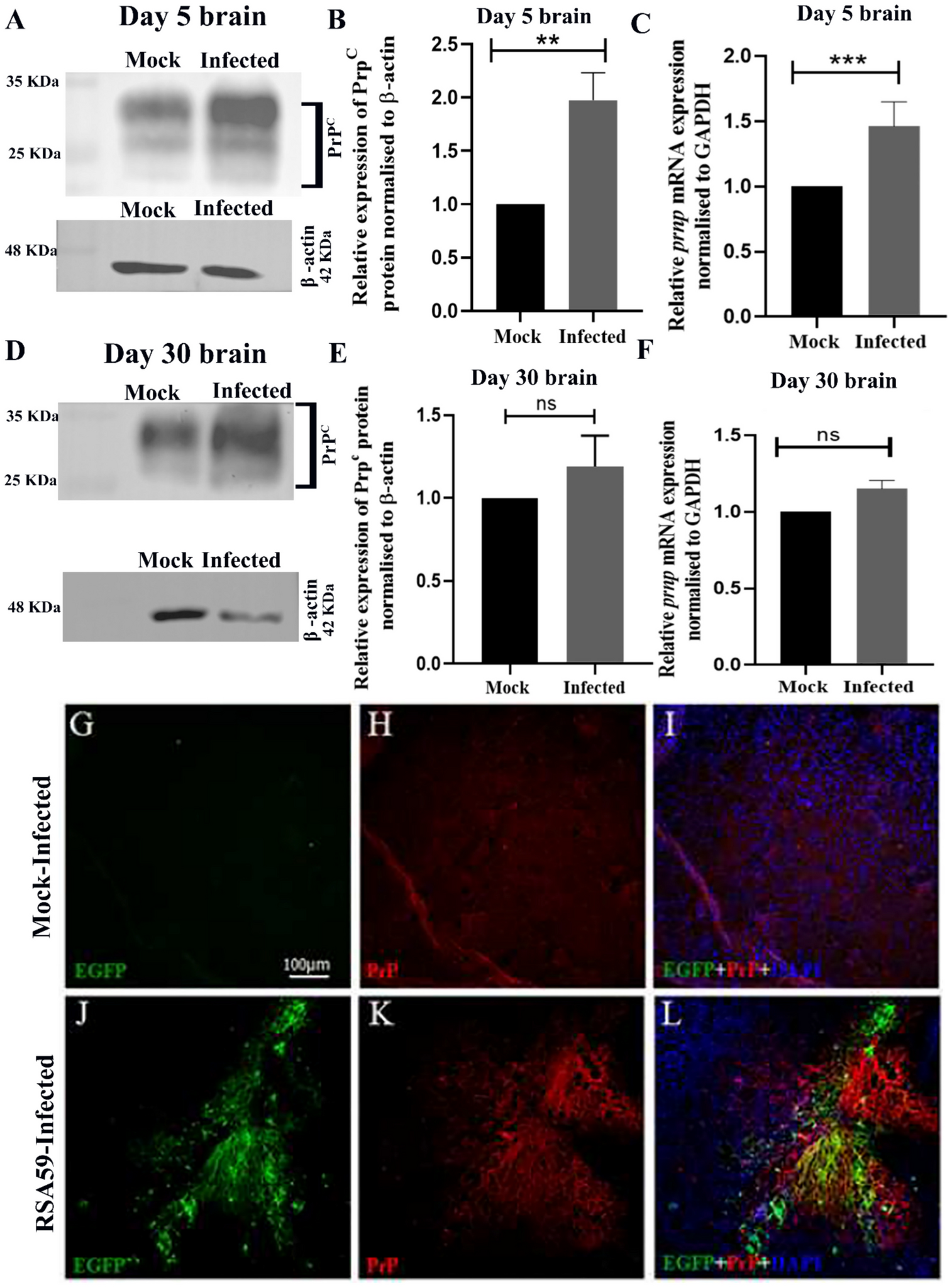 Differential expression of cellular prion protein (PrPC) in mouse hepatitis virus induced neuroinflammation