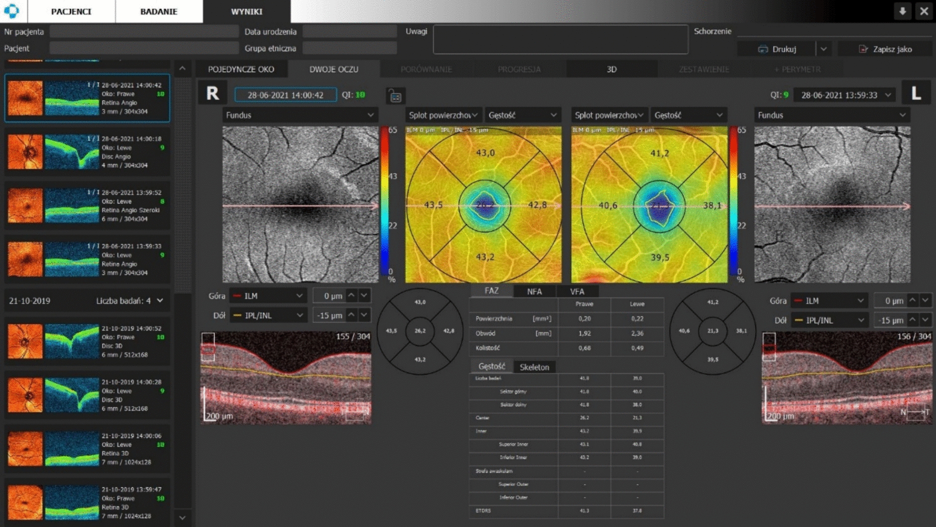 Optical coherence tomography angiography as a potential tool in differential diagnosis of multiple sclerosis and rheumatic disorders with central nervous system involvement